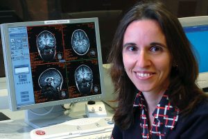 The Skinny on Memory Loss
