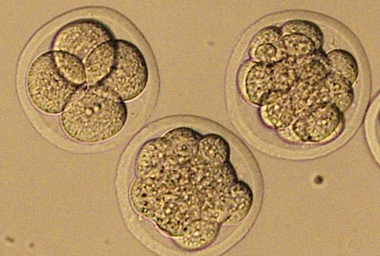 Lab–grown embryos and human–monkey hybrids: Medical marvels or ethical missteps?