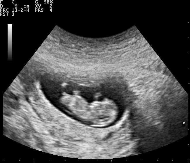 When human life begins is a question of politics – not biology